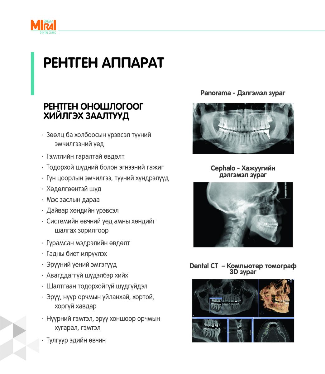 Рентген зураг